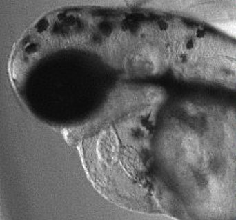 Microscopic image of Zebrafish