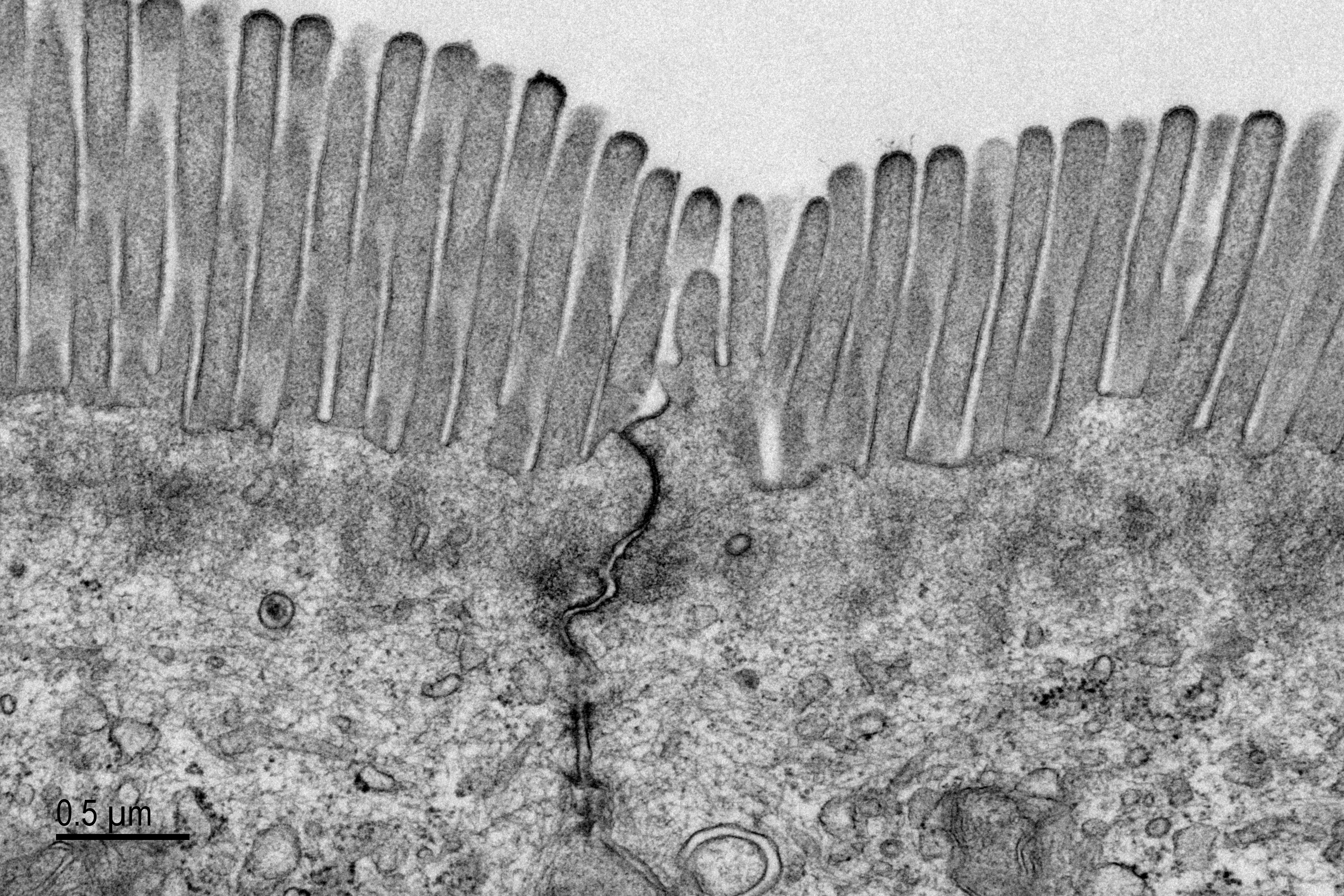 Tight junction complex from mouse intestine