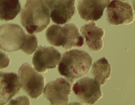 Pancreatic Organoids