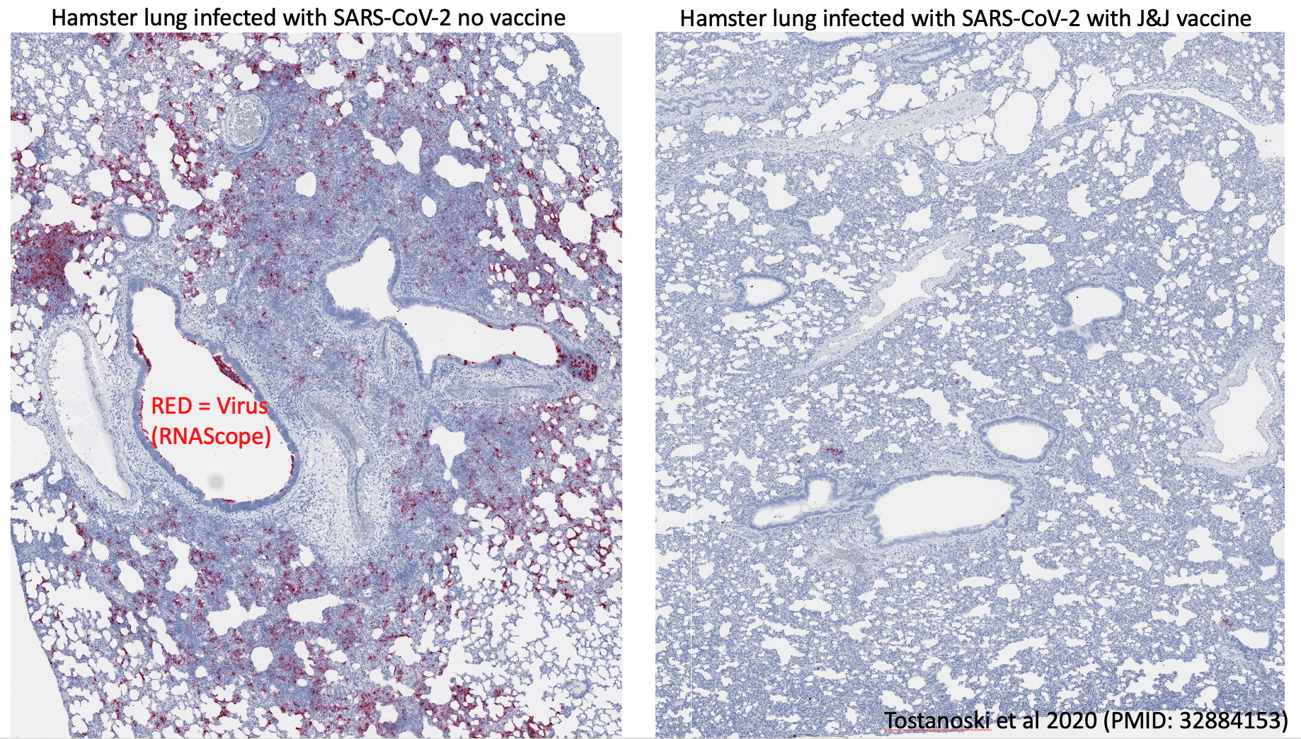 Hamster lung w-wo COVID vaccine