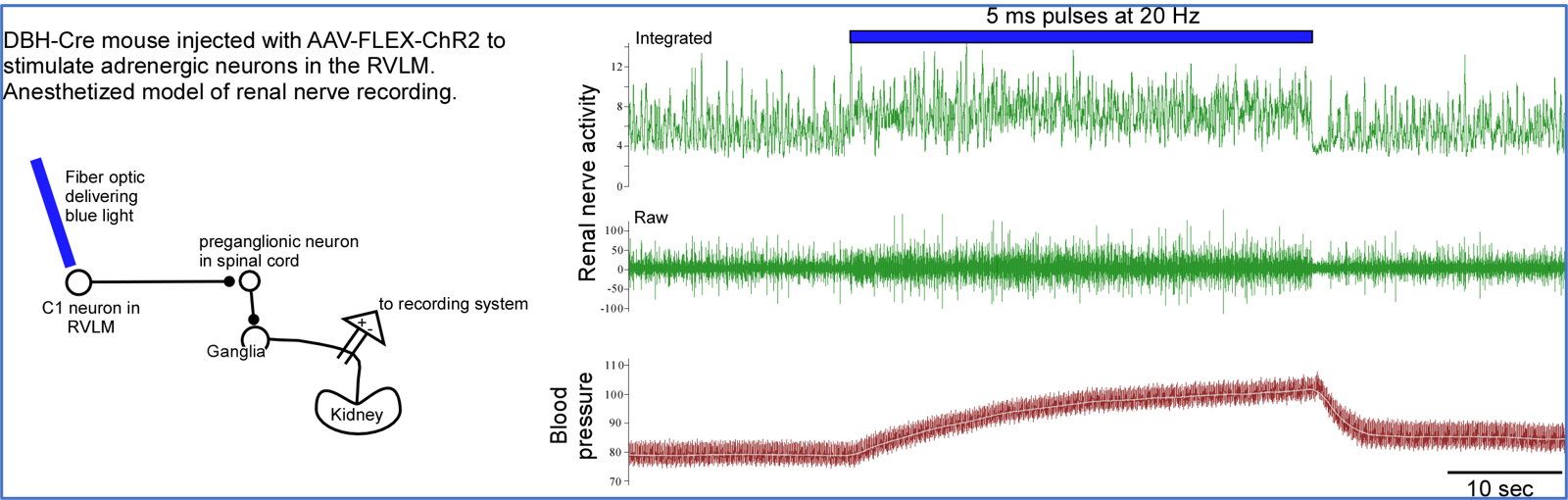laser stimulation of light sensitive cells in brain causes blood pressure rise