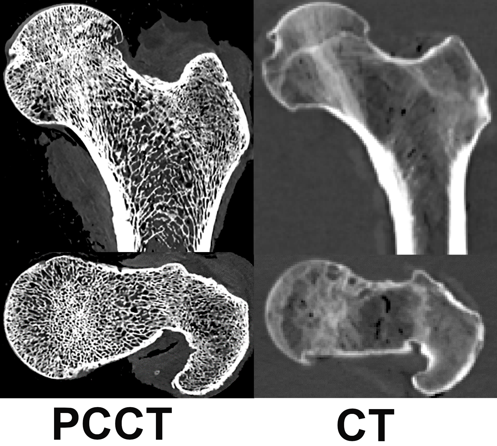PCCT Image