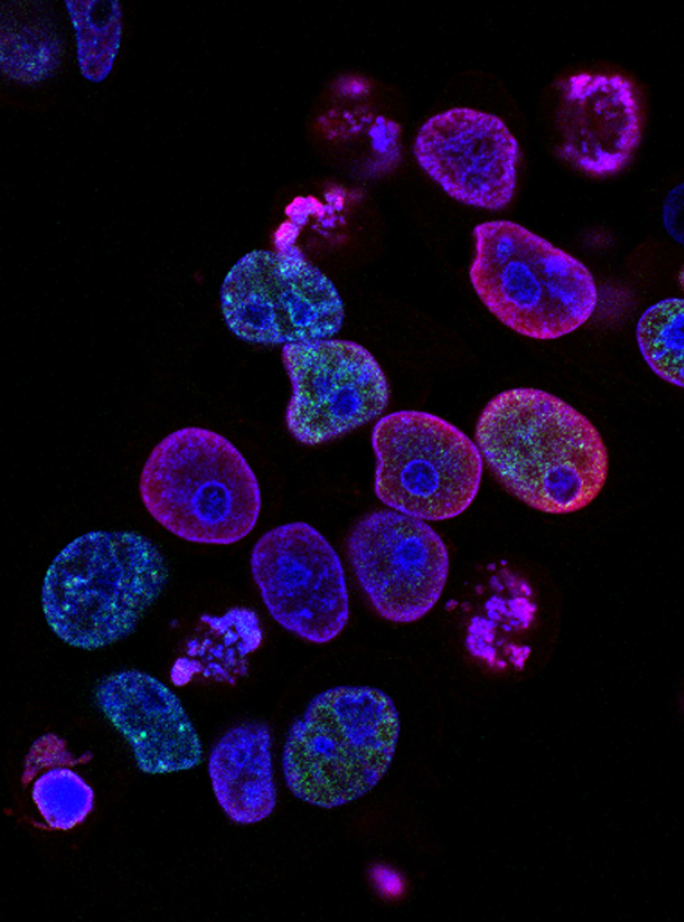 An image of colorectal cancer cells
