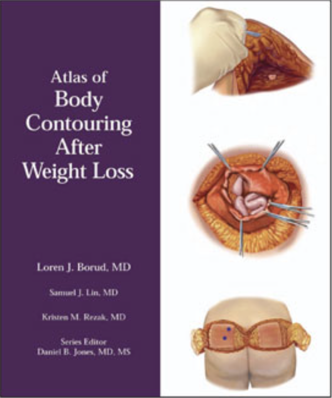 Atlas of Body Contouring