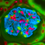 Glomerulus