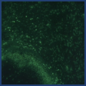 NAc and Opioid Addiction