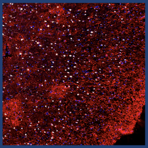 Brain Aging Image