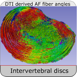intevertebal_disc_DTI)_reserach areas