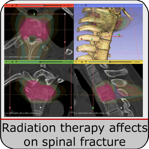 Radiation therapy