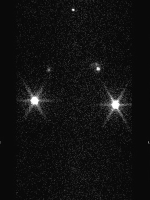 lymphoscintigraphy