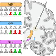 Schematic of proportion of participants with unchanged lower urinary tract function