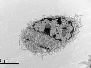 Macrophage infected with Legionella bacteria
