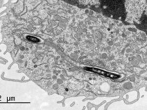 Macrophage cell infected with Legionella bacteria 