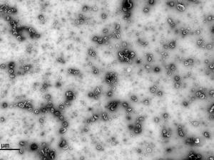 Negative staining of extra cellular vesicles 