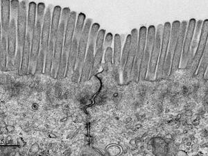 Tight junction complex from mouse intestine