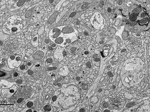 Mouse brain showing synaptic connections