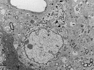 Mouse neuron with DAB labeled endoplasmic reticulum
