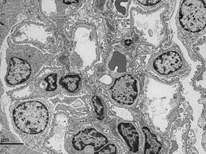 Glomerulus of mouse kidney