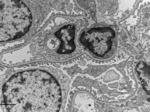 Podocytes in a glomerulus from a mouse kidney