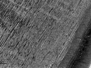 Cuticle layers from a Vanessa cardui butterfly pupa