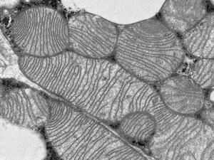 Mitochondria from high pressure frozen brown adipose tissue