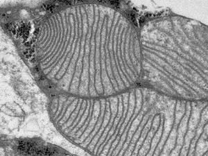 Mitochondria from high pressure frozen brown adipose tissue
