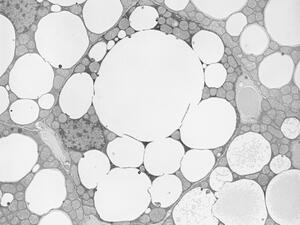 Brown adipose tissue with well preserved lipid droplets and mitochondria 