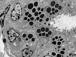 Intestinal crypt from a mouse showing paneth cells 