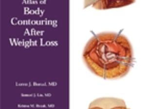 BODY CONTOURING ATLAS COVER