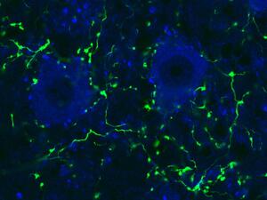 blue neuron green projections up close