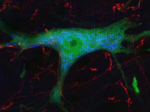 green neuron VV fav