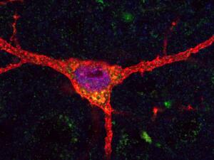 red neuron big