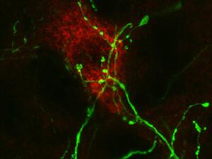 red neuron up close with green projections
