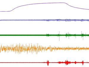 respiration activity