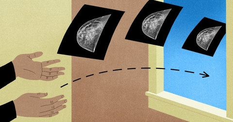Hands Tossing Mammogram Images Out the Window