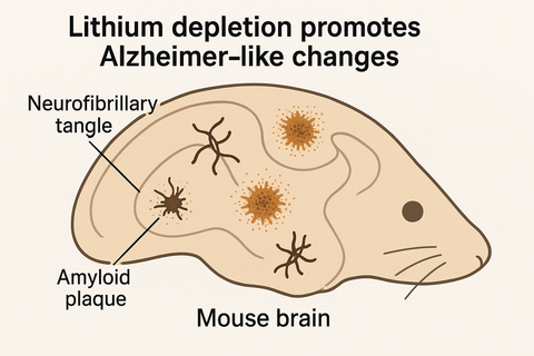 pathology in the brain causing Alzheimer's