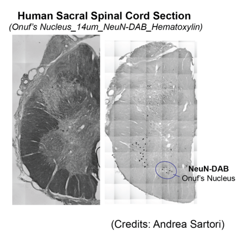 NeuN immunostaining of sacral spinal cord neurons showing location of Onuf's Nucleus