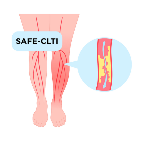 Image of leg with claudication. Label says "SAFE-CLTI"