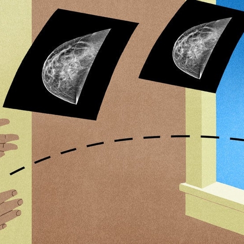 Hands Tossing Mammogram Images Out the Window