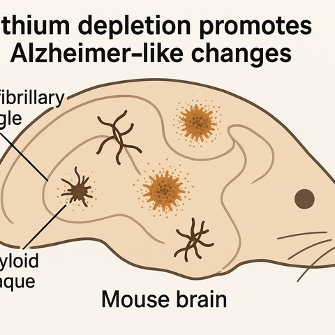 pathology in the brain causing Alzheimer's