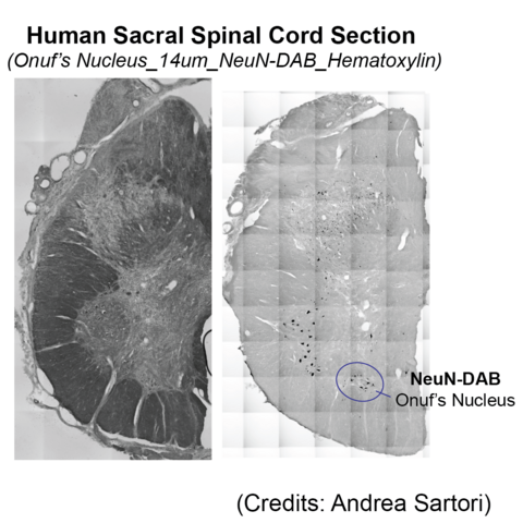 NeuN immunostaining of sacral spinal cord neurons showing location of Onuf's Nucleus