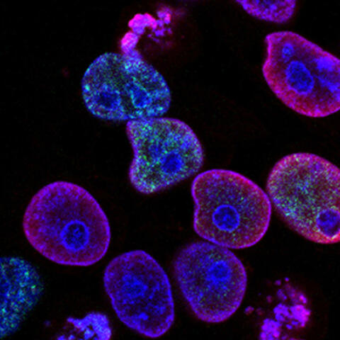 national-cancer-institute-l7en7lb-ovc-unsplash-modern-lab.jpg