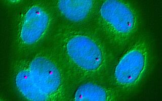 microscopic cells