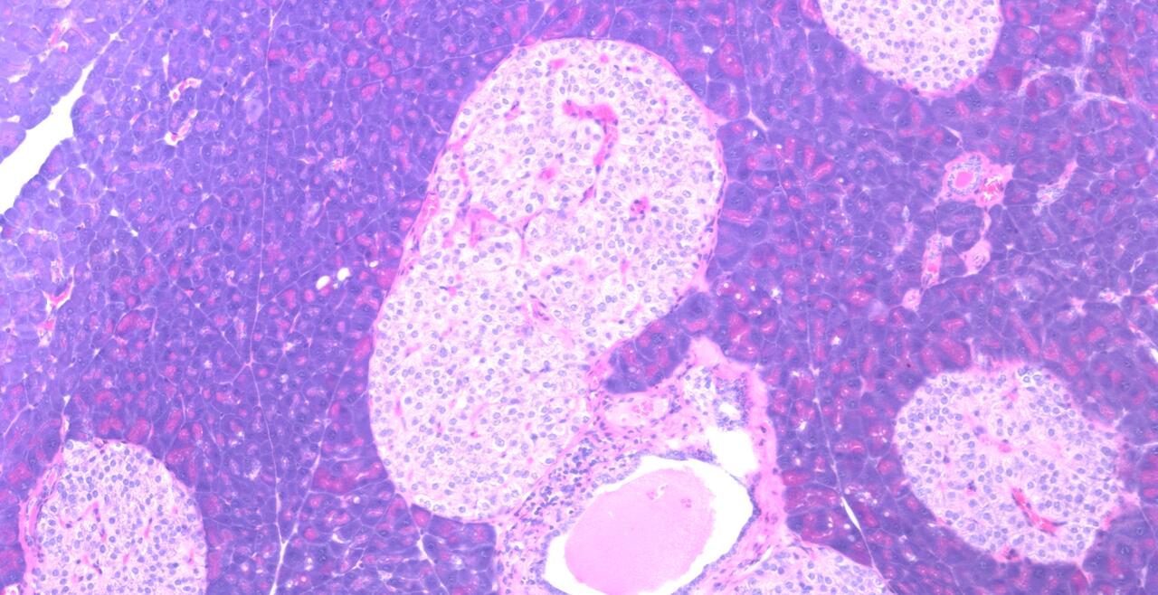 WT K233 islets