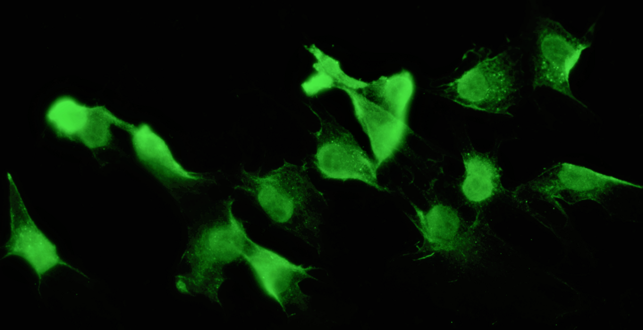 Breast Cells IF stained for A20