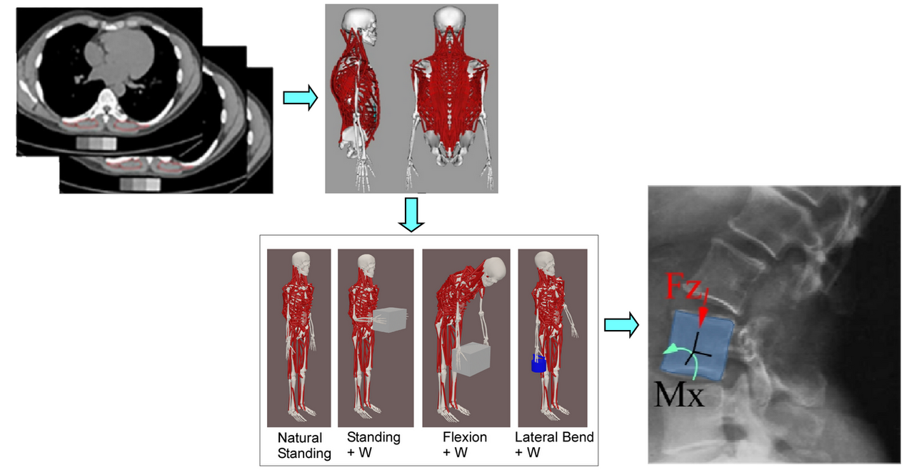 Musculoskeletal Spine models
