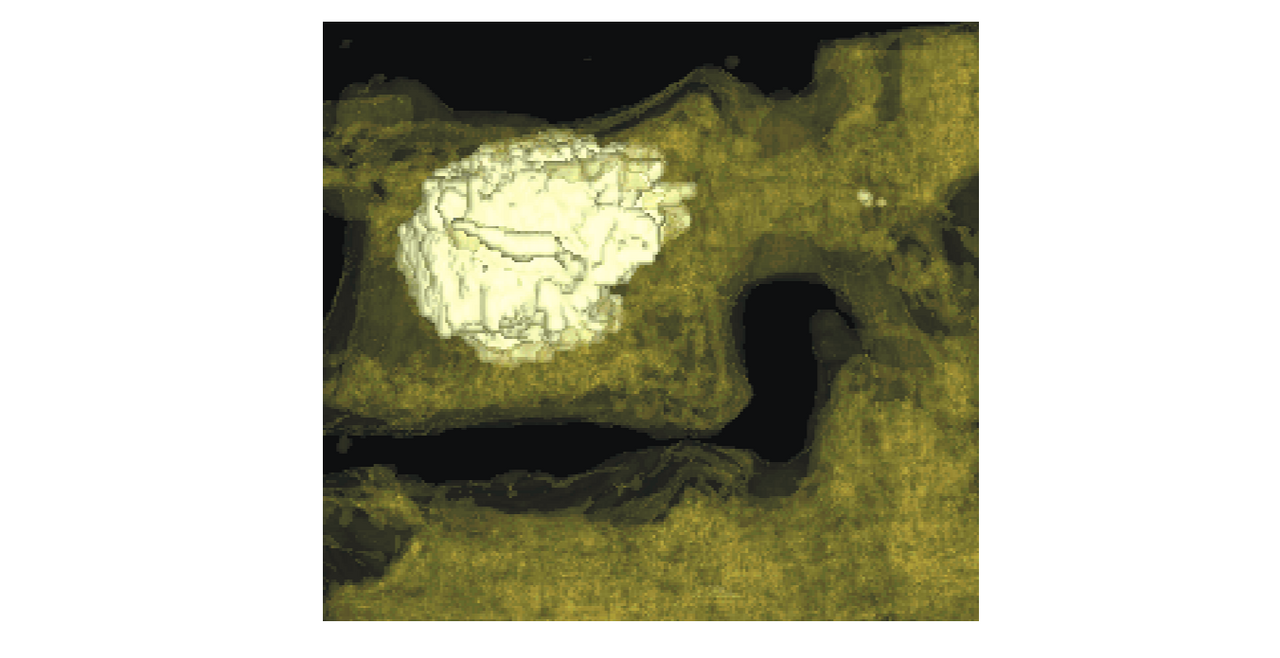 Augmentation