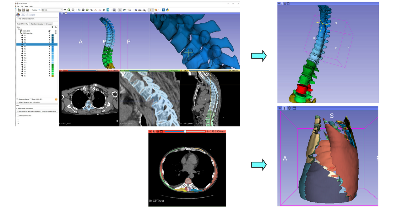 Machine learning models
