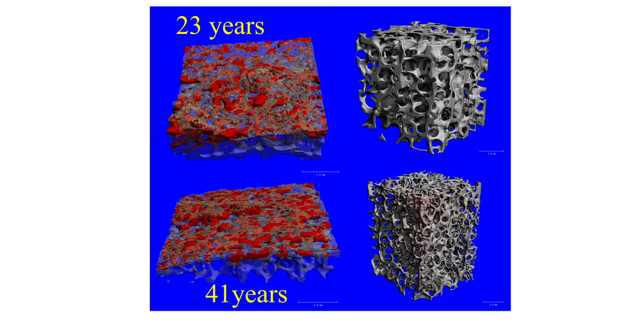 End-plate imaging