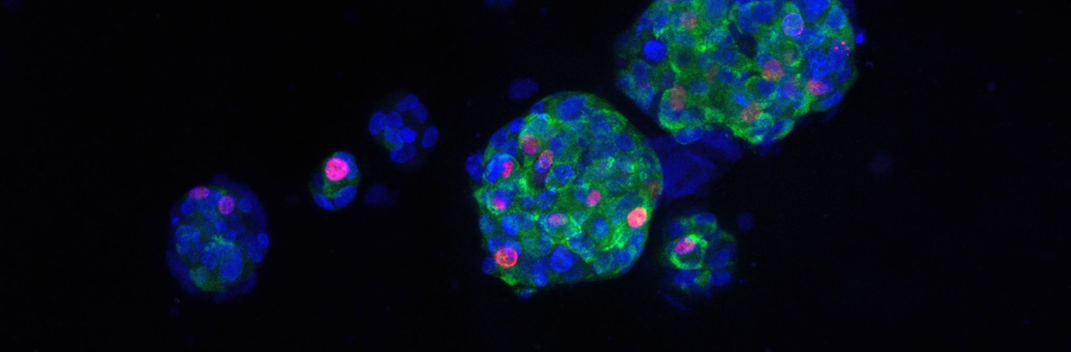 EdU labeling and pS6 staining of drug treated PDOs